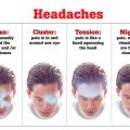 headache in Shakopee MN