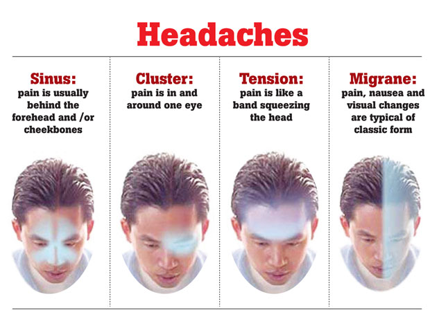 headache in Shakopee MN